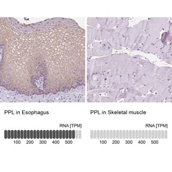 Periplakin Antibody, Novus Biologicals:Antibodies:Primary Antibodies
